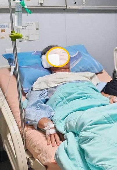 ▲鍾民臉頰被割裂廿公分,縫了卅幾針。(圖/記者謝榮浤翻攝)