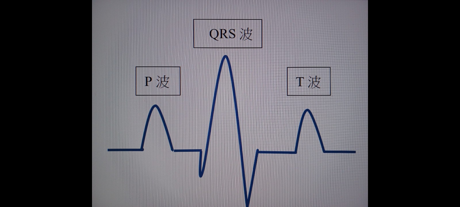 4可藉由心電圖測量的p波、qrs波與t波來判讀心臟是否異常