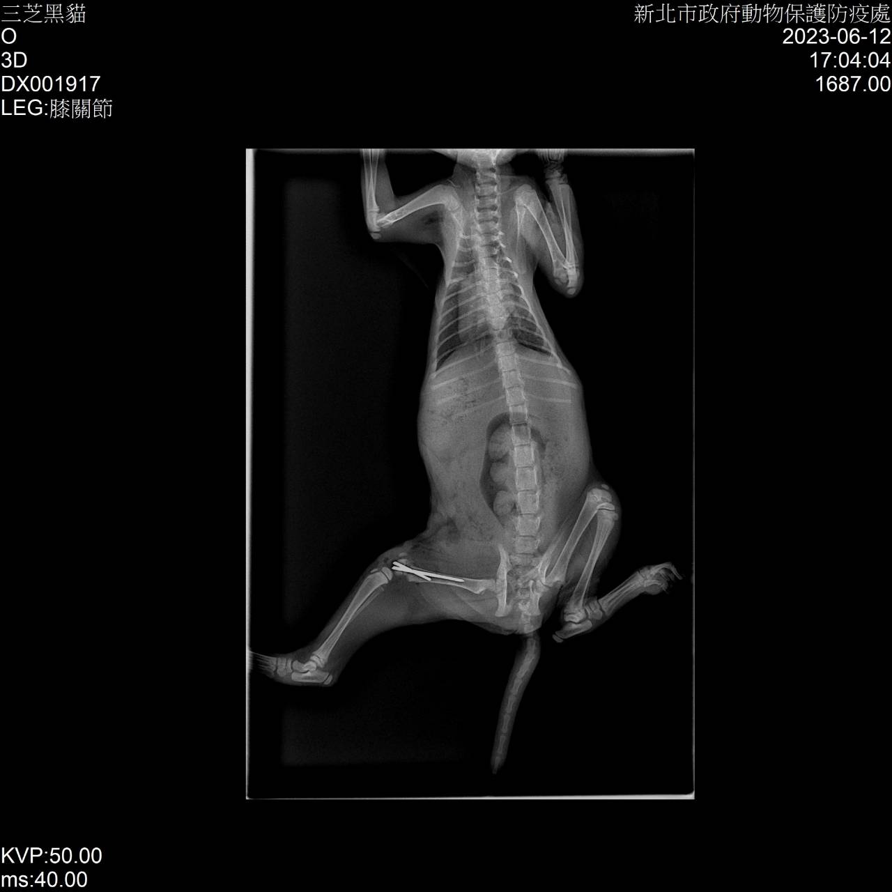 手術完成